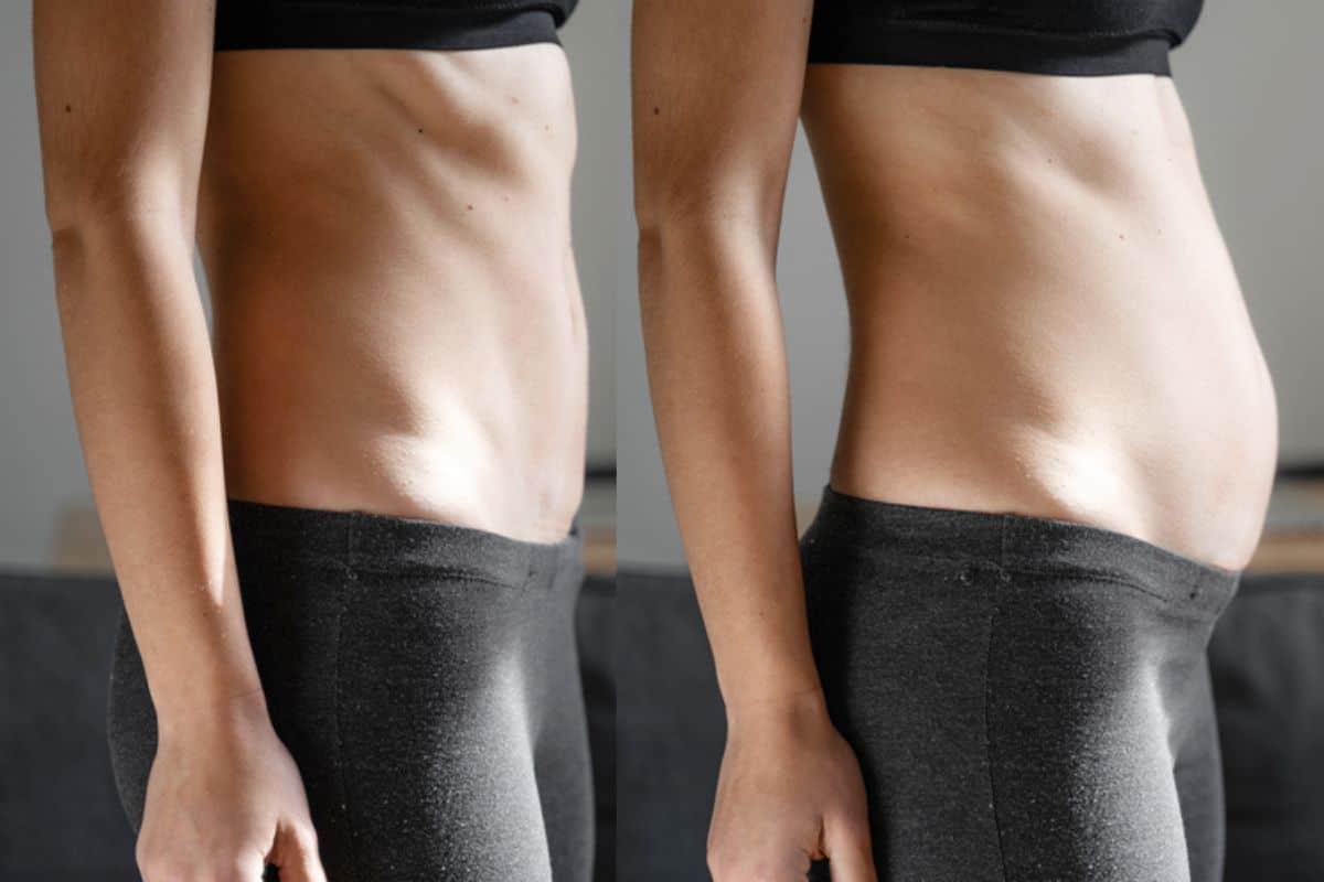 How long does diastasis recti take to improve Gerrards Cross?
