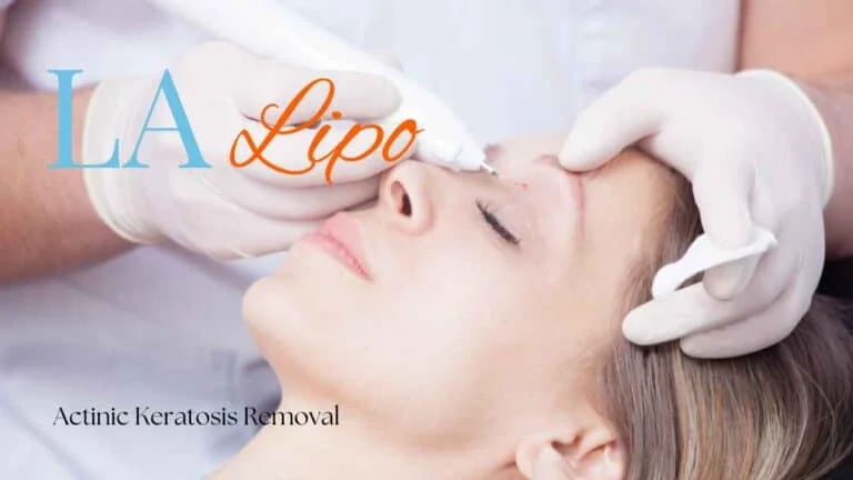 Woman receiving Actinic Keratosis Removal Treatment Gerrards Cross
