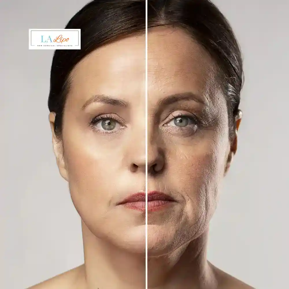 How Can You Tell If Non-Surgical Skin Tightening Is Right for You Gerrards Cross?